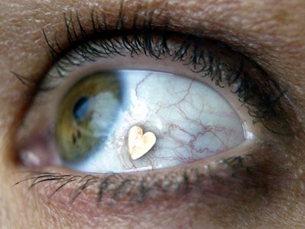 Tendencias: Implantes microdermales en los ojos