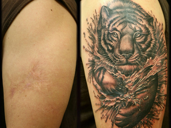 Tatuajes sobre quemaduras: medidas que debes tomar