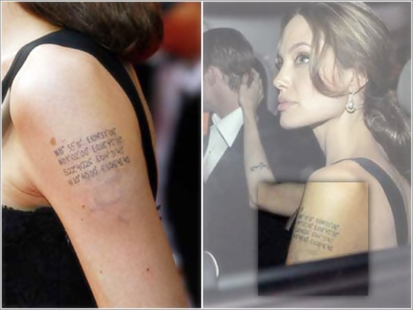 Famosos que borraron sus tatuajes