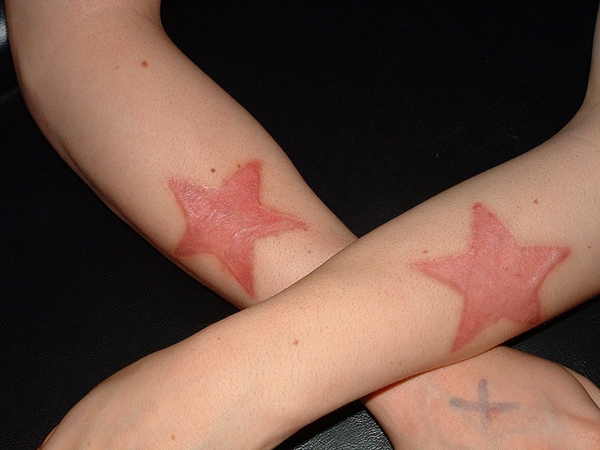 Tatuajes con t&eacute;cnica branding