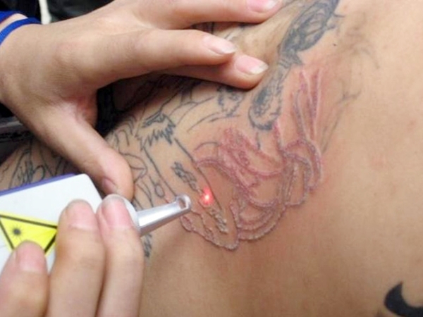 &iquest;Sientes arrepentimiento por haberte tatuado?