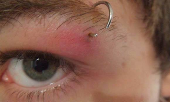 Razones por las que nuestro cuerpo rechaza los piercings