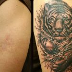 Tatuajes sobre quemaduras: medidas que debes tomar. (tatuajex.com) Todos los derechos reservados.