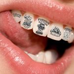 La nueva moda: Tatuajes en los dientes. (tatuajex.com) Todos los derechos reservados.