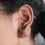 ¿Cómo evitar los queloides en las orejas?. (tatuajex.com) Todos los derechos reservados.