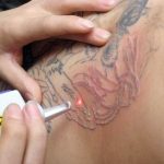 ¿Sientes arrepentimiento por haberte tatuado?. (tatuajex.com) Todos los derechos reservados.