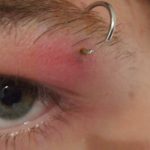 Razones por las que nuestro cuerpo rechaza los piercings. (tatuajex.com) Todos los derechos reservados.