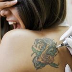 ¿Es posible hacerse un tatuaje permanente sin dolor?. (tatuajex.com) Todos los derechos reservados.